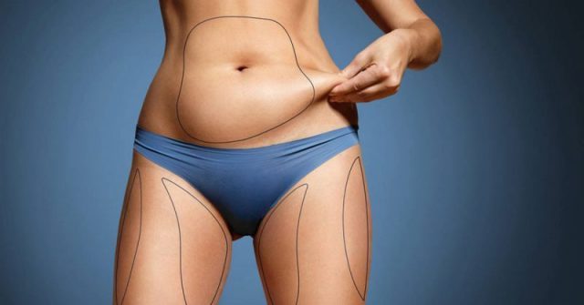 lipo for smaller waist