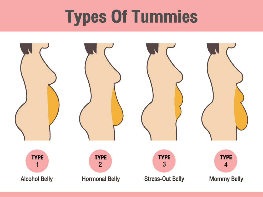 mini tummy tuck scars