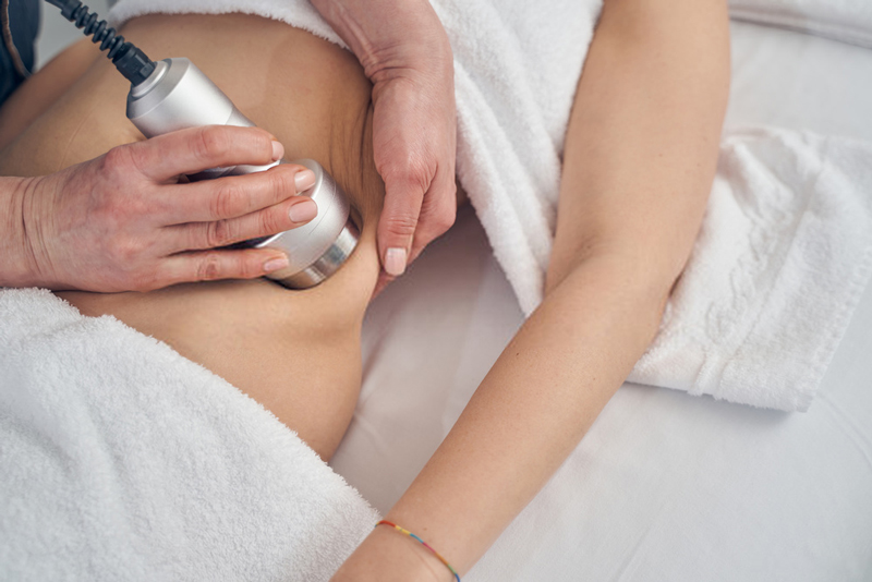 Ultrasonic Cavitation for Cellulite Treatment